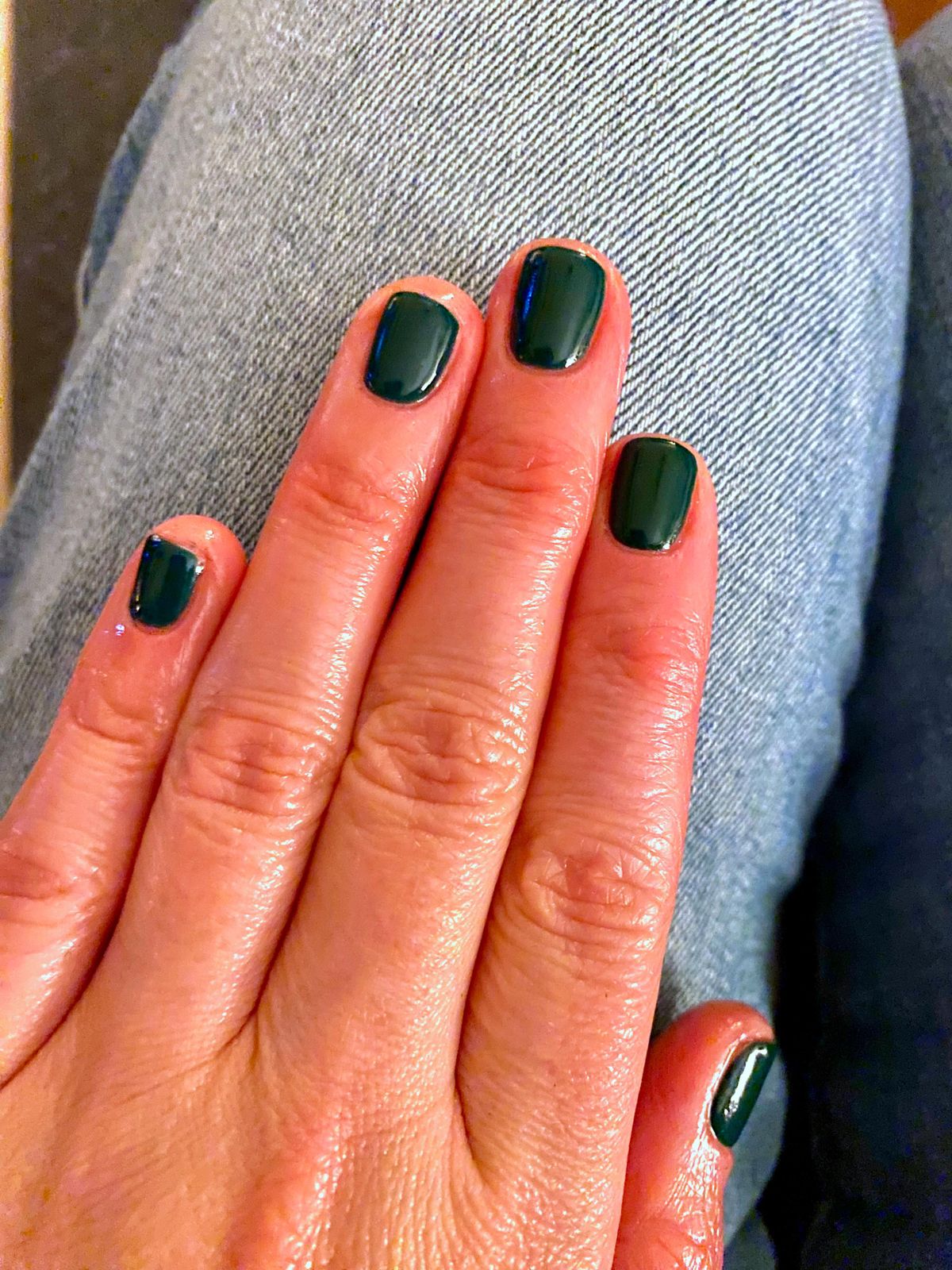 Forest Green High-Gloss Nails Forest Green High-Gloss Nails — Winter Nail Colors for Short Nails